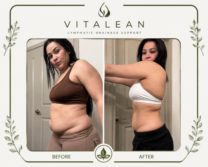 Vitalean ™ Lymphatic Drainage Drops