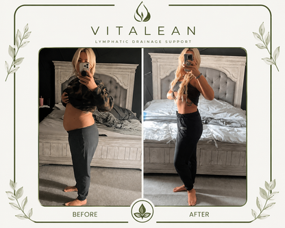 Vitalean ™ Lymphatic Drainage Drops